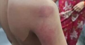 విద్యార్థిని చితకబాదిన టీచర్